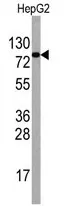 EIF4B Rabbit Polyclonal Antibody - image 1