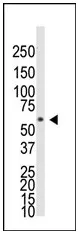 BMPR1A (N-term) Rabbit Polyclonal Antibody - image 1