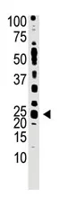 Cripto1 (TDGF1) (N-term) Rabbit Polyclonal Antibody - image 1