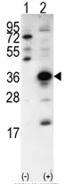 SNAIL (SNAI1) (N-term) Rabbit Polyclonal Antibody - image 1