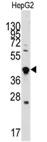GDF3 Rabbit Polyclonal Antibody - image 1