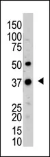 UCH37 (UCHL5) (N-term) Rabbit Polyclonal Antibody - image 1