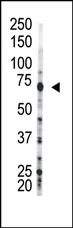 USP2 (N-term) Rabbit Polyclonal Antibody - image 1