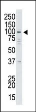 USP13 (Center) Rabbit Polyclonal Antibody - image 1