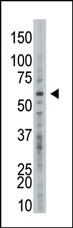 USP21 (C-term) Rabbit Polyclonal Antibody - image 1