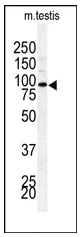 BAP1 (N-term) Rabbit Polyclonal Antibody - image 1