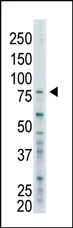 BAP1 (C-term) Rabbit Polyclonal Antibody - image 1
