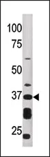 ART1 Rabbit Polyclonal Antibody - image 1