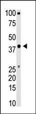 Bmi1 (COMMD3-BMI1) (C-term) Rabbit Polyclonal Antibody - image 1
