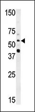 NMT2 (N-term) Rabbit Polyclonal Antibody - image 1