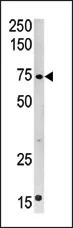 CPT2 (C-term) Rabbit Polyclonal Antibody - image 1