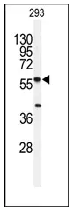 SPTLC1 (N-term) Rabbit Polyclonal Antibody - image 1
