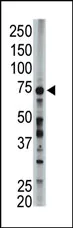 ACSL6 Rabbit Polyclonal Antibody - image 1