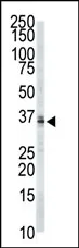 PPT1 (C-term) Rabbit Polyclonal Antibody - image 1