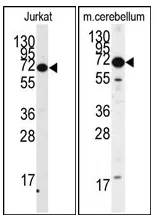 MeCP2 Rabbit Polyclonal Antibody - image 1