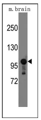 SEMA5A (C-term) Rabbit Polyclonal Antibody - image 1