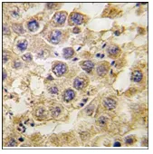 NANOS2 (C-term) Rabbit Polyclonal Antibody - image 1