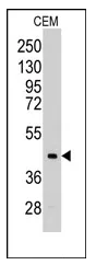 Aldolase C (ALDOC) (C-term) Rabbit Polyclonal Antibody - image 1