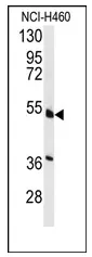 HNF 4 alpha (HNF4A) Rabbit Polyclonal Antibody - image 1