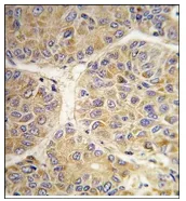 AASS Rabbit Polyclonal Antibody - image 1