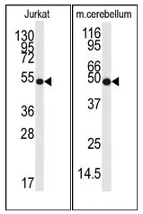 NSE (ENO2) Rabbit Polyclonal Antibody - image 1
