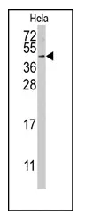 RFC5 (Center) Rabbit Polyclonal Antibody - image 1