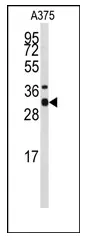 Syntaxin 3 (STX3) (Center) Rabbit Polyclonal Antibody - image 1