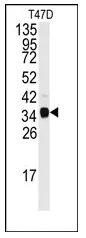 Nucleophosmin (NPM1) (N-term) Rabbit Polyclonal Antibody - image 1