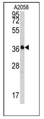 POLR1C (C-term) Rabbit Polyclonal Antibody - image 1