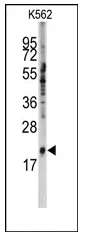 SNRPC (C-term) Rabbit Polyclonal Antibody - image 1