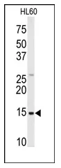 SNRPD1 (Center) Rabbit Polyclonal Antibody - image 1