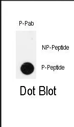 PDX1 pThr11 Rabbit Polyclonal Antibody - image 1