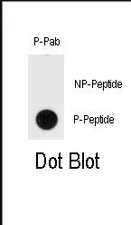 Telomerase reverse transcriptase (TERT) pTyr707 Rabbit Polyclonal Antibody - image 1