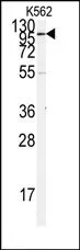Angiotensin Converting Enzyme 2 (ACE2) (N-term) Rabbit Polyclonal Antibody - image 1