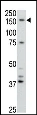 ABCB4 Rabbit Polyclonal Antibody - image 1