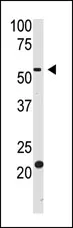 BACE2 (Center) Rabbit Polyclonal Antibody - image 1