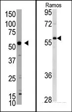 XIAP (N-term) Rabbit Polyclonal Antibody - image 1