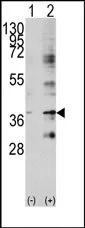 Livin (BIRC7) (C-term) Rabbit Polyclonal Antibody - image 1