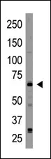 CRY2 (C-term) Rabbit Polyclonal Antibody - image 1