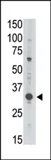 MAGEA3 (C-term) Rabbit Polyclonal Antibody - image 1