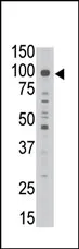 MAGED1 Rabbit Polyclonal Antibody - image 1