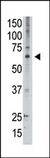 MAGED2 (C-term) Rabbit Polyclonal Antibody - image 1