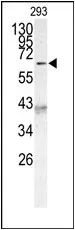 AF9 (MLLT3) (C-term) Rabbit Polyclonal Antibody - image 1