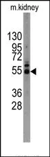 MMP12 (C-term) Rabbit Polyclonal Antibody - image 1