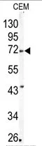 MMP24 Rabbit Polyclonal Antibody - image 1