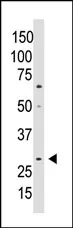 CCN5 (Center) Rabbit Polyclonal Antibody - image 1
