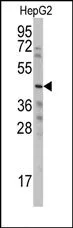 CCN6 (Center) Rabbit Polyclonal Antibody - image 1