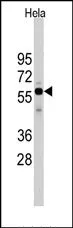 CDC25A Rabbit Polyclonal Antibody - image 1