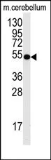 CDC25A Rabbit Polyclonal Antibody - image 1
