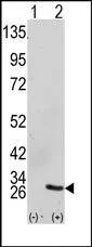 GRB2 Rabbit Polyclonal Antibody - image 1
